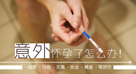 无痛人流