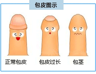 西宁切割包皮价格