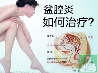 盆腔炎的治疗有哪种