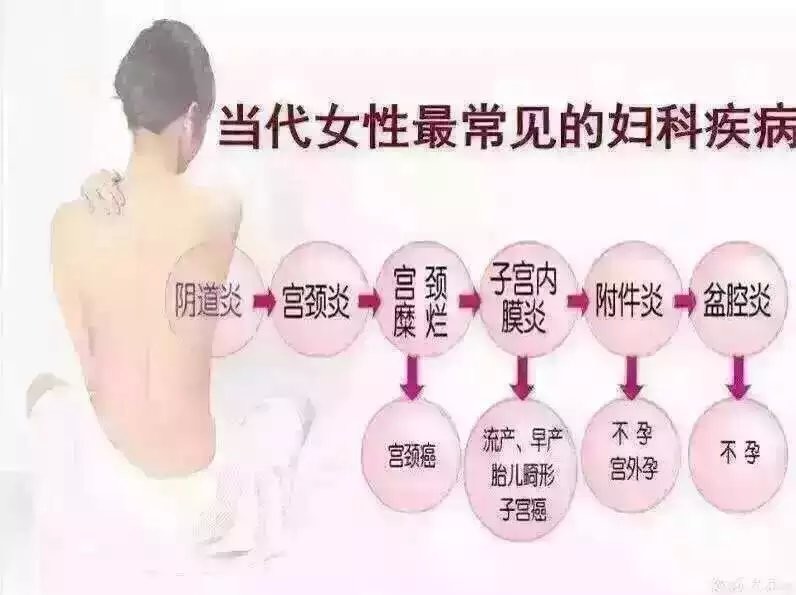 慢性宫颈炎如何治疗